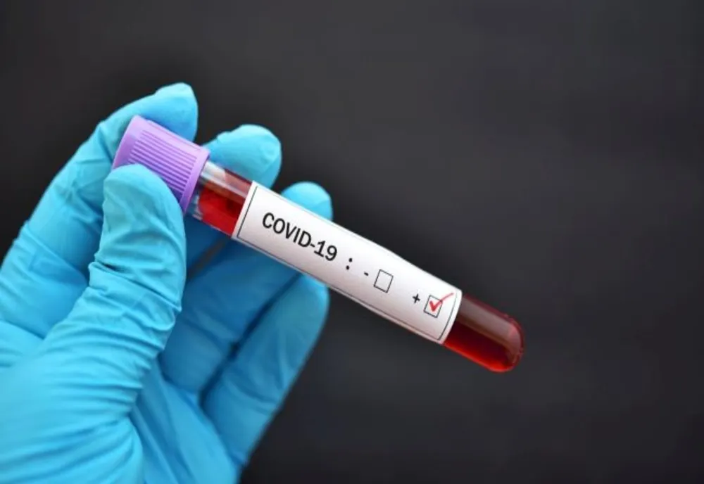 COVID-19: România înregistrează un nou record de decese. Câte cazuri noi sunt în județe