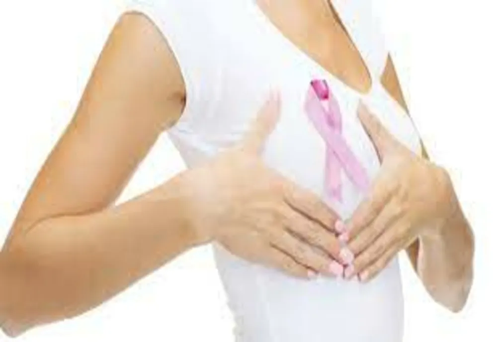 Sesiune de informare medicală bilingvă cu medici specialiști în cancerul de sân