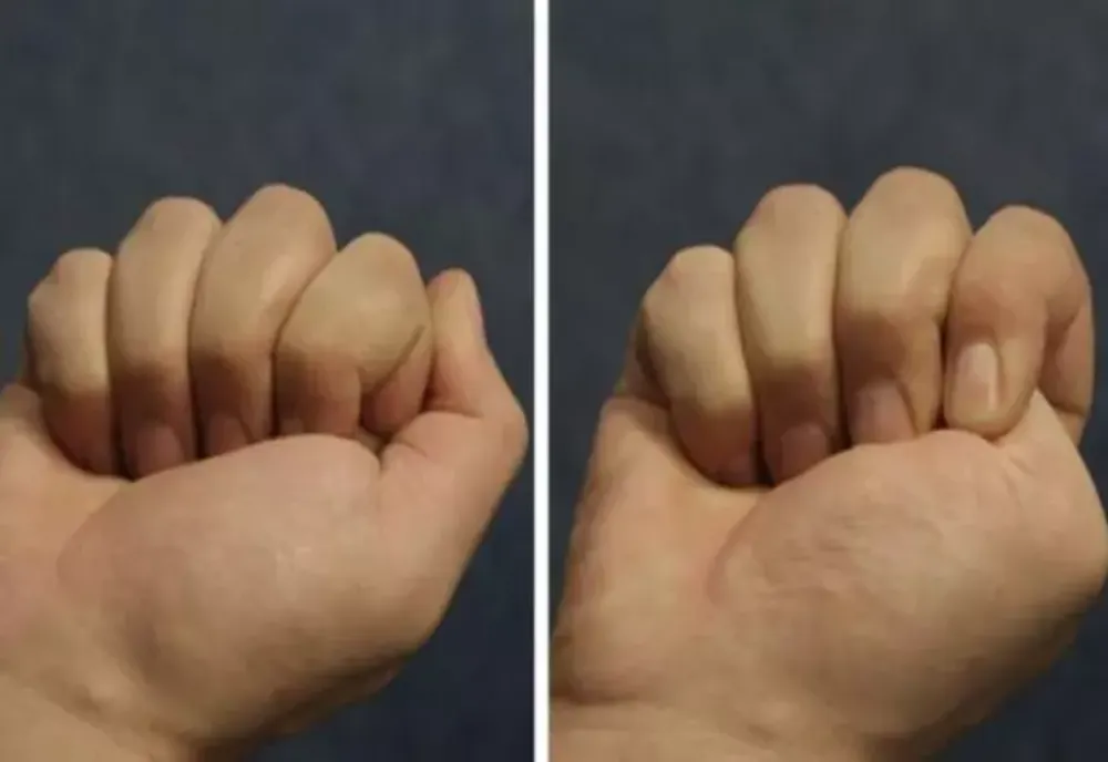 Testul care îţi spune cele mai ascunse lucruri despre tine. Tu cum strângi pumnul?