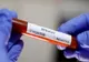 Încă un covăsnean testat pozitiv pentru coronavirus. Bilanţul îmbolnăvirilor ajunge la 124