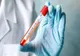 264 de cazuri de COVID-19. Încă 4 covăsneni infectați