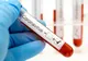 COVID-19 Testare gratuită, la Sfântu Gheorghe, pentru persoanele simptomatice COVID