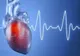 Liste de așteptare de două luni pentru copii, la Spitalul de recuperare cardiovasculară din Covasna